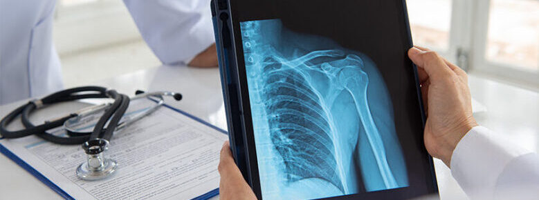 Médecin tenant une radio